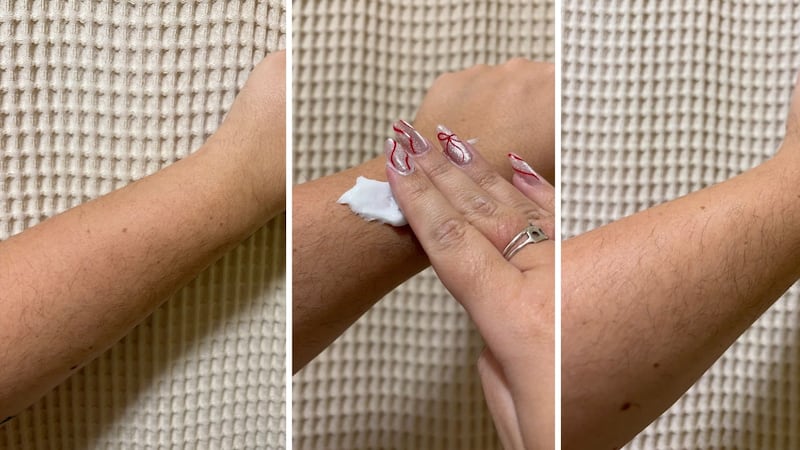 Bianca applying the cream to her arm