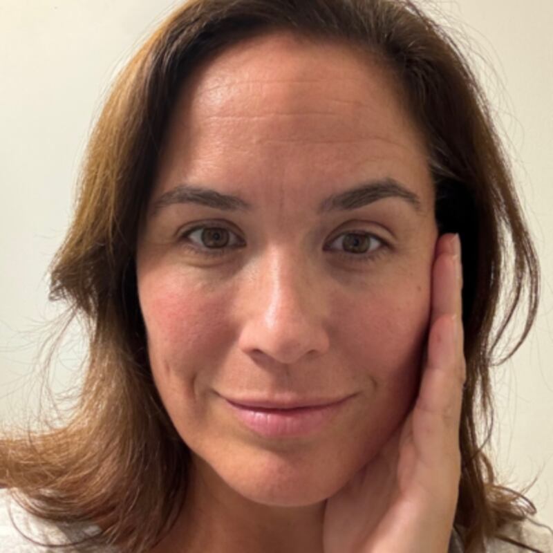 Valérie Sardin showing results of the NuDerma Skin Therapy Wand on her skin